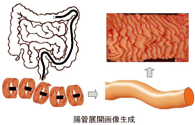 Deformable Registration